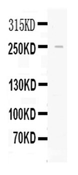 Apolipoprotein B/APOB Rabbit Polyclonal Antibody
