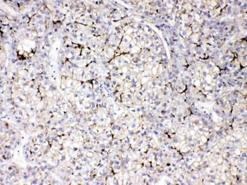 Apolipoprotein B/APOB Rabbit Polyclonal Antibody