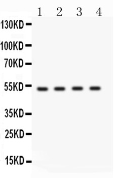 BDKRB2 Rabbit Polyclonal Antibody