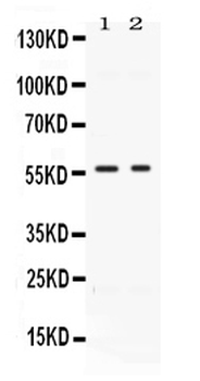 BMP15 Rabbit Polyclonal Antibody