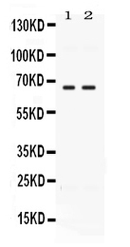 CCDC6 Rabbit Polyclonal Antibody