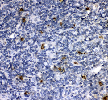 Cathepsin G/CTSG Rabbit Polyclonal Antibody