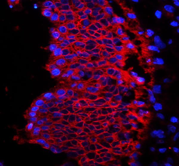 EpCAM Rabbit Polyclonal Antibody