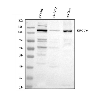 CSB/ERCC6 Rabbit Polyclonal Antibody