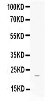 FGF21 Antibody