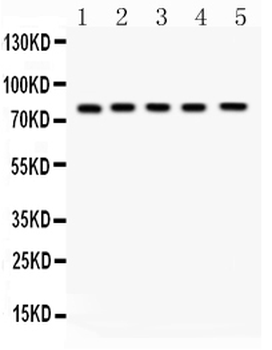 FSH Receptor/FSHR Rabbit Polyclonal Antibody