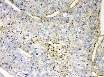 GNB1 Rabbit Polyclonal Antibody