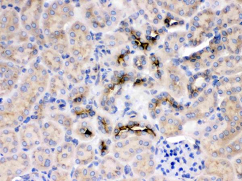 GNB1 Rabbit Polyclonal Antibody