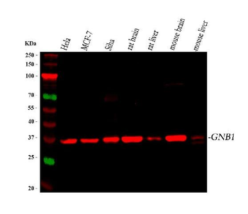 GNB1 Rabbit Polyclonal Antibody