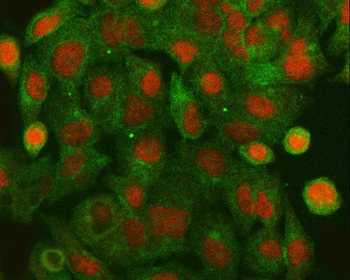HLTF Rabbit Polyclonal Antibody