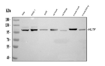 HLTF Rabbit Polyclonal Antibody