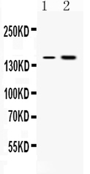 Insulin Receptor/INSR Rabbit Polyclonal Antibody