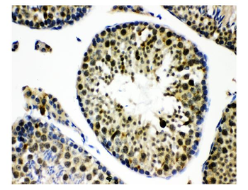 KDM5B/PLU1/Jarid1B Antibody