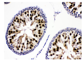 KDM5B/PLU1/Jarid1B Antibody