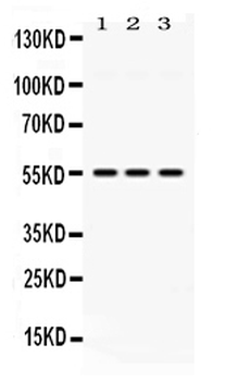 MPP1 Rabbit Polyclonal Antibody
