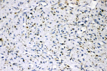 ADFP/PLIN2 Rabbit Polyclonal Antibody