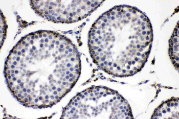 ADFP/PLIN2 Rabbit Polyclonal Antibody