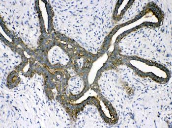 Phosphoserine Aminotransferase/PSAT1 Rabbit Polyclonal Antibody