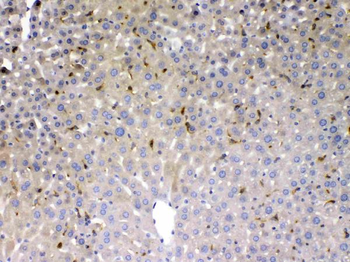 Phosphoserine Aminotransferase/PSAT1 Rabbit Polyclonal Antibody