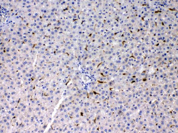 Phosphoserine Aminotransferase/PSAT1 Rabbit Polyclonal Antibody