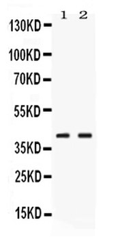 Phosphoserine Aminotransferase/PSAT1 Rabbit Polyclonal Antibody