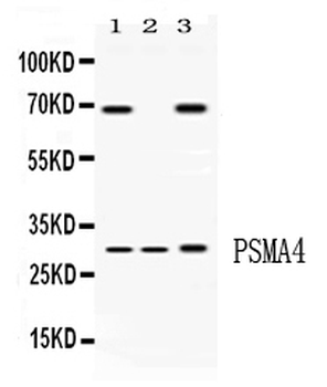 PSMA4 Rabbit Polyclonal Antibody