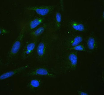 RPL19 Rabbit Polyclonal Antibody