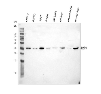 RPL19 Rabbit Polyclonal Antibody