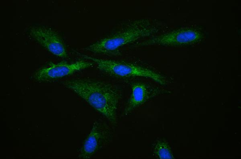 MPS1/RPS27 Rabbit Polyclonal Antibody