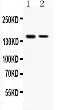 SAFB Rabbit Polyclonal Antibody