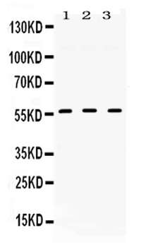 TGF beta Receptor I/TGFBR1 Rabbit Polyclonal Antibody