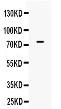 ACSL3 Rabbit Polyclonal Antibody