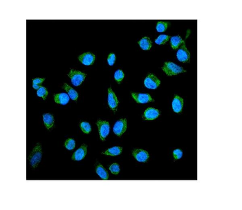 Placental alkaline phosphatase (PLAP)/ALPP Antibody
