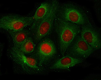 Angiogenin/ANG Rabbit Polyclonal Antibody