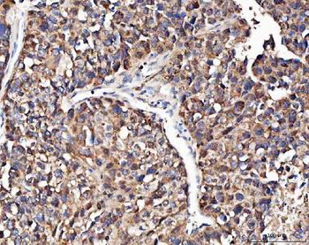 Angiogenin/ANG Rabbit Polyclonal Antibody