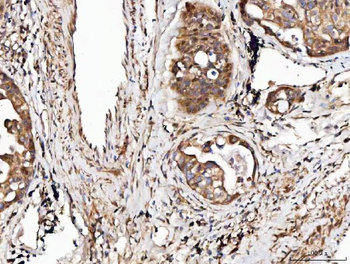 Angiogenin/ANG Rabbit Polyclonal Antibody