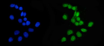 APRT Rabbit Polyclonal Antibody