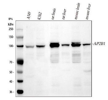 AP2B1 Rabbit Polyclonal Antibody
