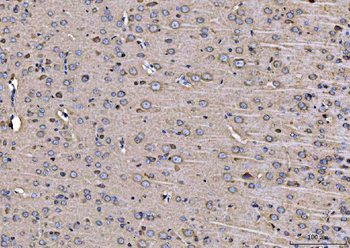 ARFGAP1 Rabbit Polyclonal Antibody