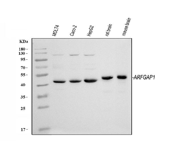 ARFGAP1 Rabbit Polyclonal Antibody