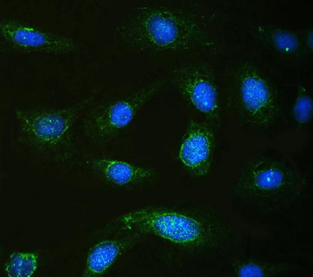 Calpastatin/CAST Rabbit Polyclonal Antibody