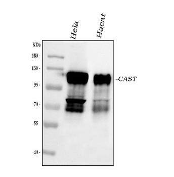 Calpastatin/CAST Rabbit Polyclonal Antibody