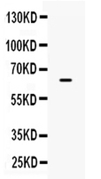 PD-L1/B7-H1/CD274/PD Rabbit Polyclonal Antibody