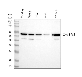 Cytochrome P450 17A1/CYP17A1 Rabbit Polyclonal Antibody