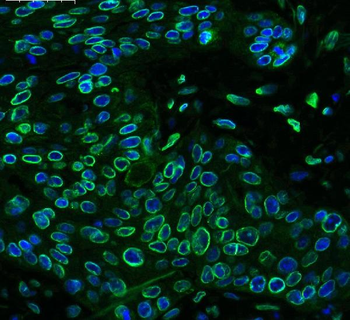 Emerin/EMD Rabbit Polyclonal Antibody