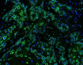 Emerin/EMD Rabbit Polyclonal Antibody