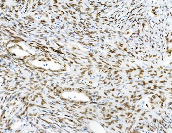 Emerin/EMD Rabbit Polyclonal Antibody