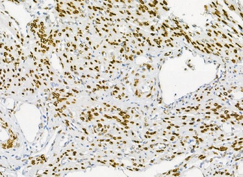 Emerin/EMD Rabbit Polyclonal Antibody