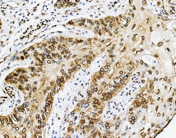 Emerin/EMD Rabbit Polyclonal Antibody