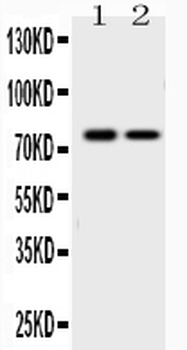 GAB1 Rabbit Polyclonal Antibody